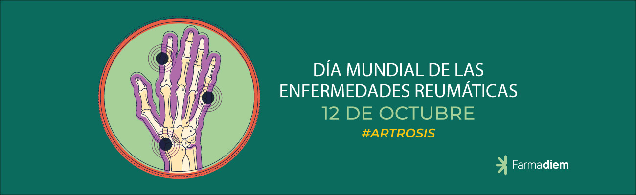 día mundial de la artrosis