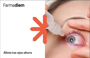 Picor de ojos por alergia: qué es y cómo aliviarlo