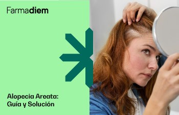 Alopecia areata: qué es, causas y tratamientos