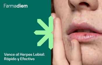 Herpes labial: causas, contagio y tratamiento