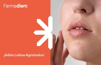 Labios agrietados: cómo mejorar su aspecto